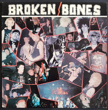 Load image into Gallery viewer, Broken Bones - Never Say Die